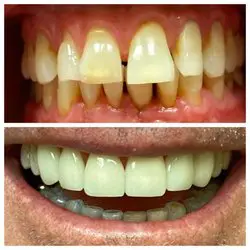Smile Image Smile Image