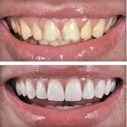 Smile Image Smile Image