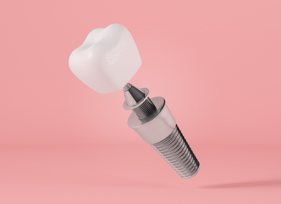 Why You Shouldn’t Get Cheap Dentures