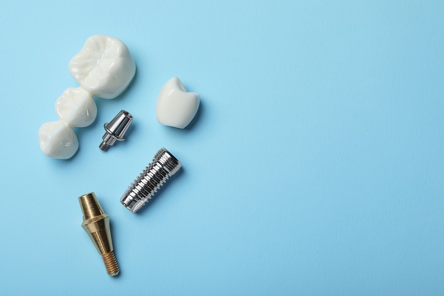 What Is The Difference Between Dentures & Dental Implants?