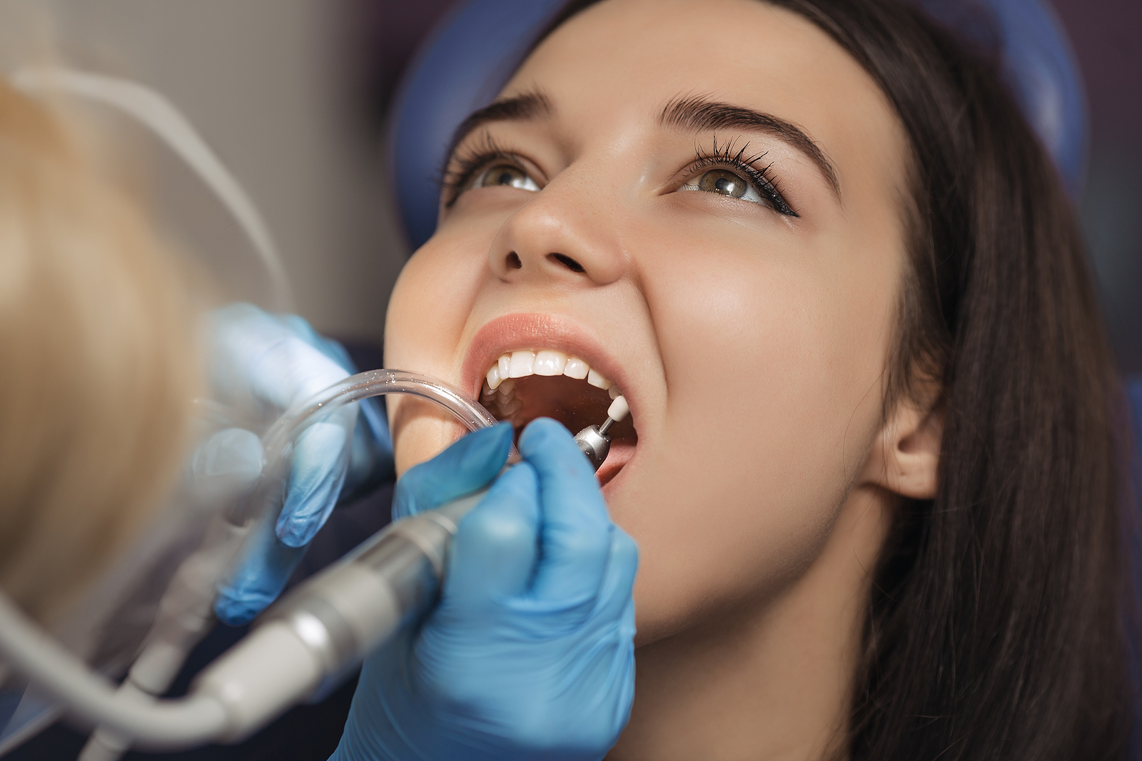 The Science Behind Fluoride Treatment in Riverside, CA: How It Protects Your Teeth