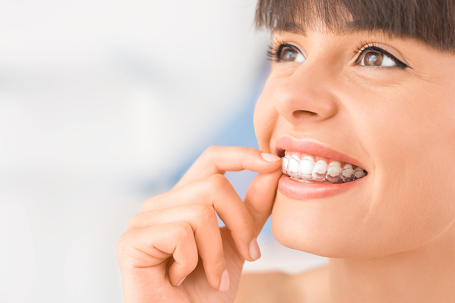 A Clear Path to a Perfect Smile: Invisalign in Riverside, CA
